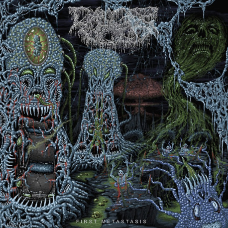 Cancer Void (CZ) "First Metastasis" MLP