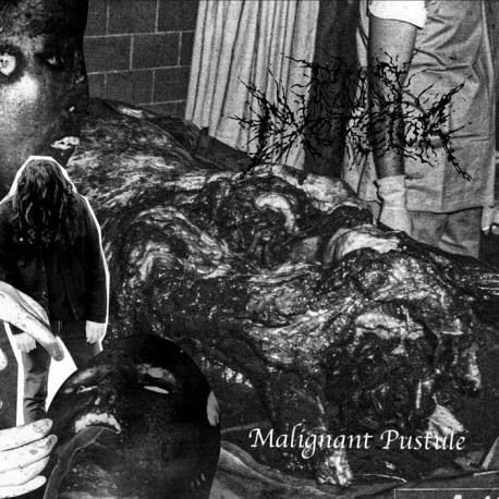 Pus Excretor (Mex) "Malignant Pustule" EP
